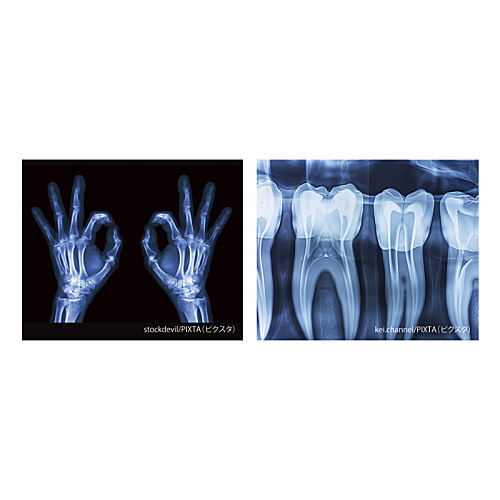 X-ray light [1.A]