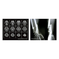X-ray light [2.B]