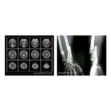 X-ray light [2.B]