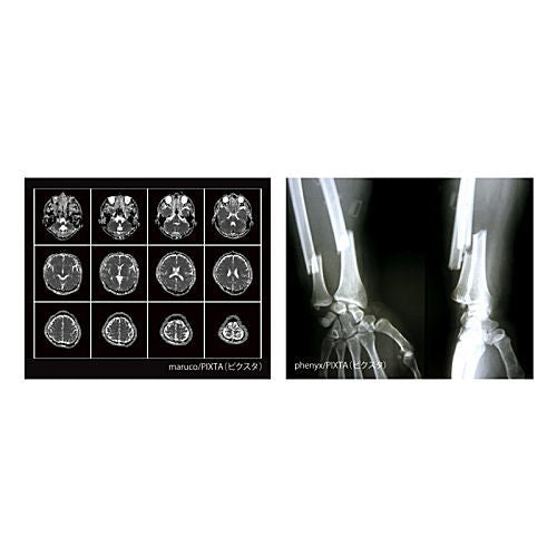 X-ray light [2.B]