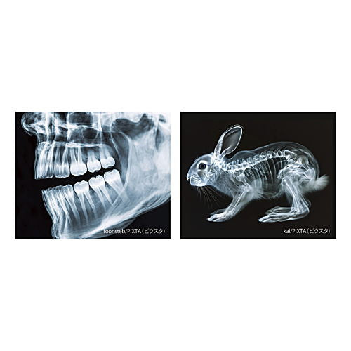 X-ray light [3.C]