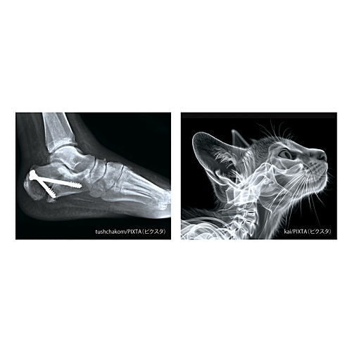 X-ray light [4.D]