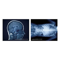 X-ray light [5.E]