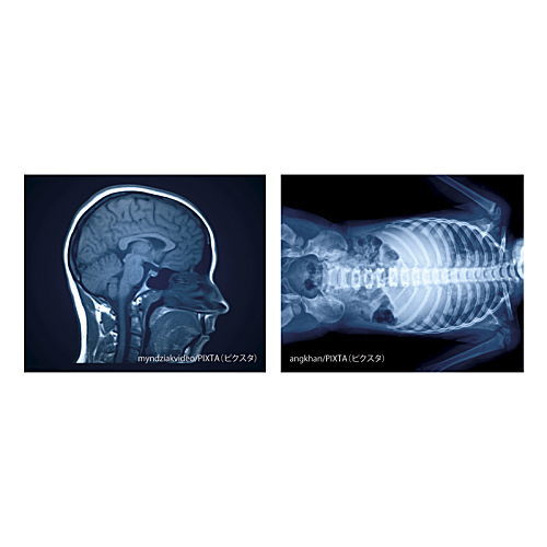 X-ray light [5.E]