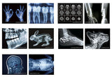 X-ray light [All 5 type set(Full Complete)]